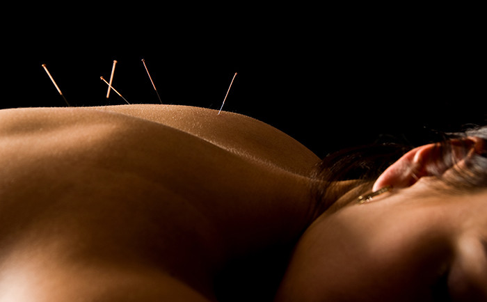 Une vie Zen : Essayez l’acupuncture pour combattre le stress