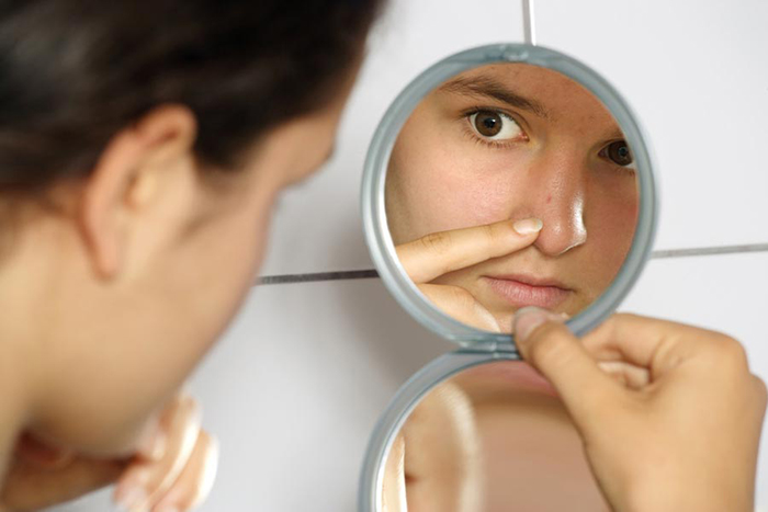 Comment concocter un masque anti-boutons fait maison ?