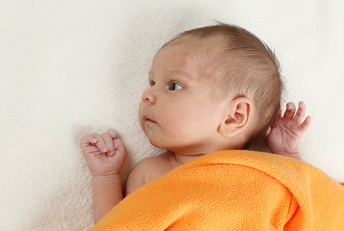 Eczéma chez l’enfant : comprendre et agir